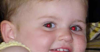  Mungkin anda pernah melihat hasil jepretan gambar dengan kondisi mata merah  Penjelasan Terjadinya Mata Merah hasil Jepretan Kamera