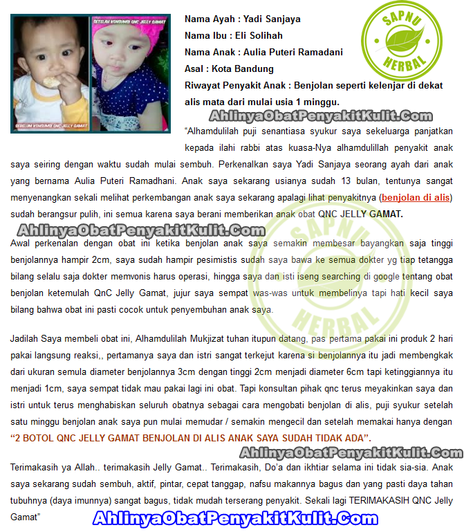 Obat Benjolan Di Siku Tangan ini TERBUKTI AMPUH Menyembuhkan Benjolan di Siku Tangan Obat Benjolan Di Siku Tangan ini TERBUKTI AMPUH Menyembuhkan Benjolan di Siku Tangan