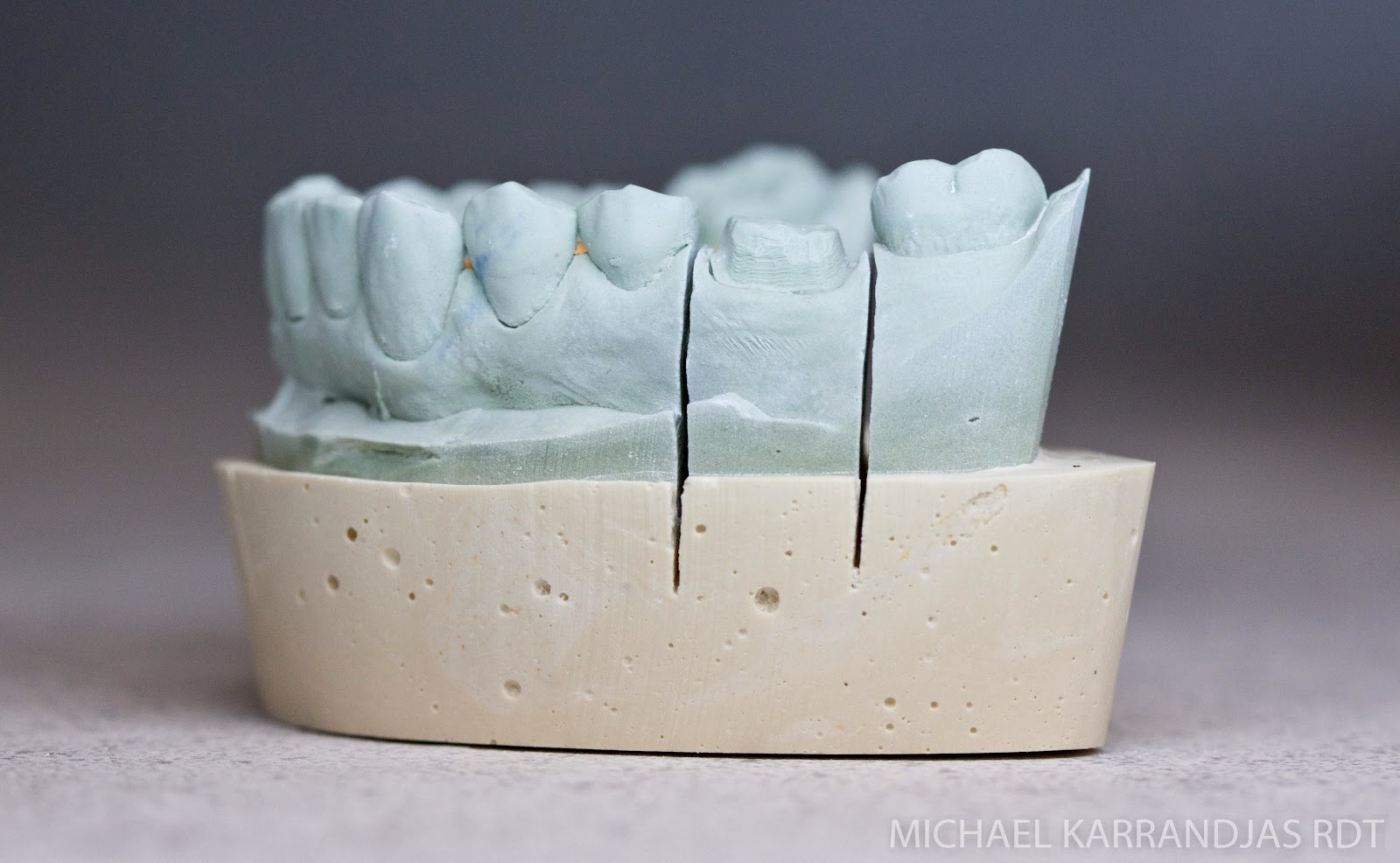 Dental Lab Model Fabrication Making Noise And Drinking Beer