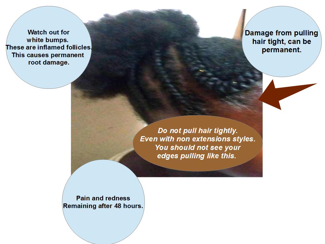 CoilyQueens™ HELP, my braid extensions are to tight!