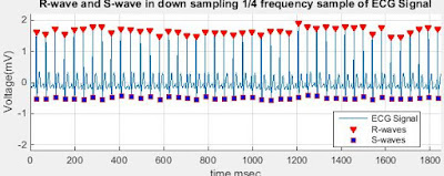 matlab ecg labview signal biomedical processing tools using projects sampling plot rate