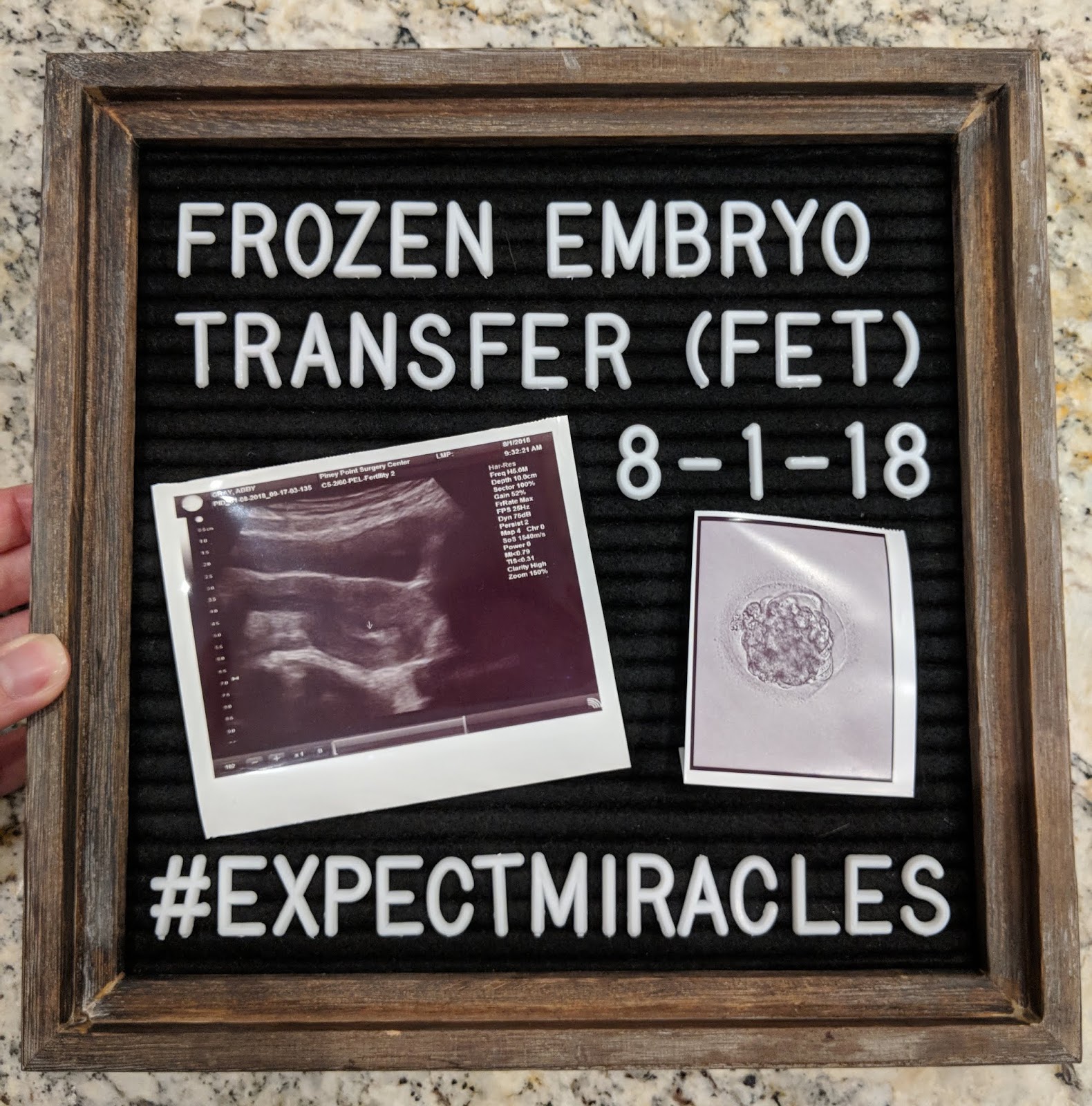 Our "secret" Frozen Embryo Transfer