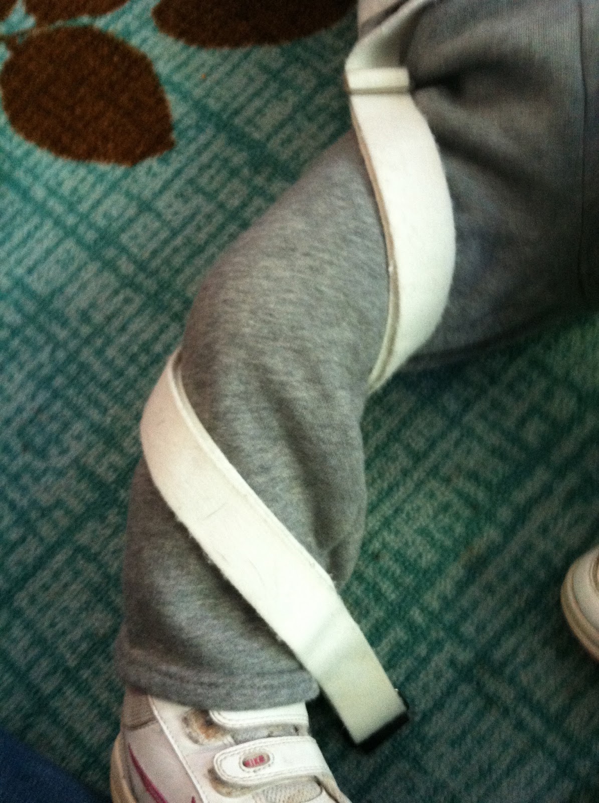 Rachel's Journey with Spina Bifida DeRotation Straps Tutorial