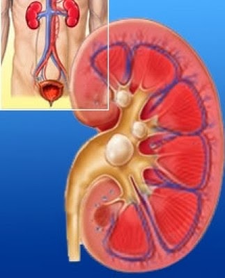 „Nisip la rinichi”. Simptomele care te anunță că trebuie faci o vizită medicului urolog | Digi24