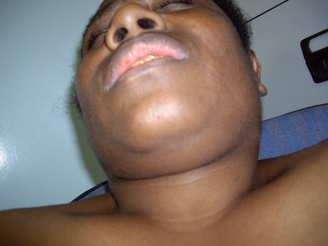 Papua New Guinea Porn