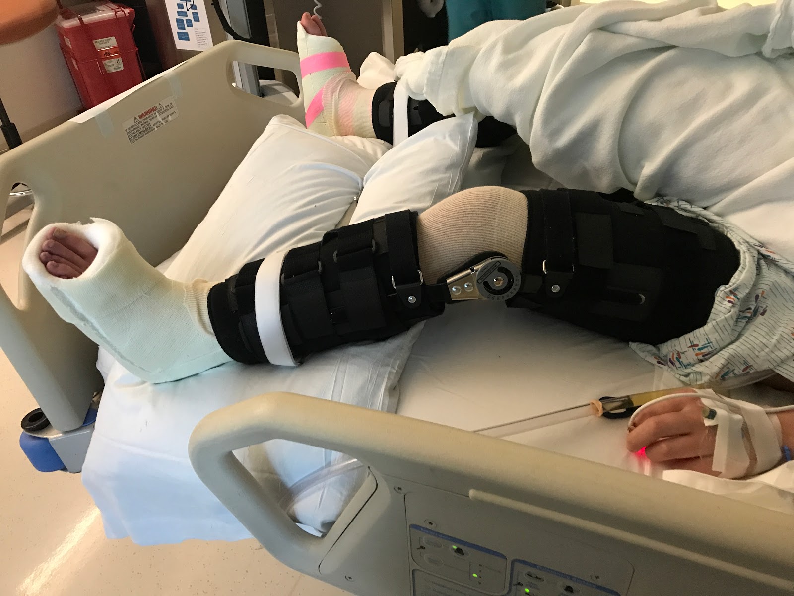 Ainsley Rae Happy To Be Me Calcaneal Osteotomies and Hamstring