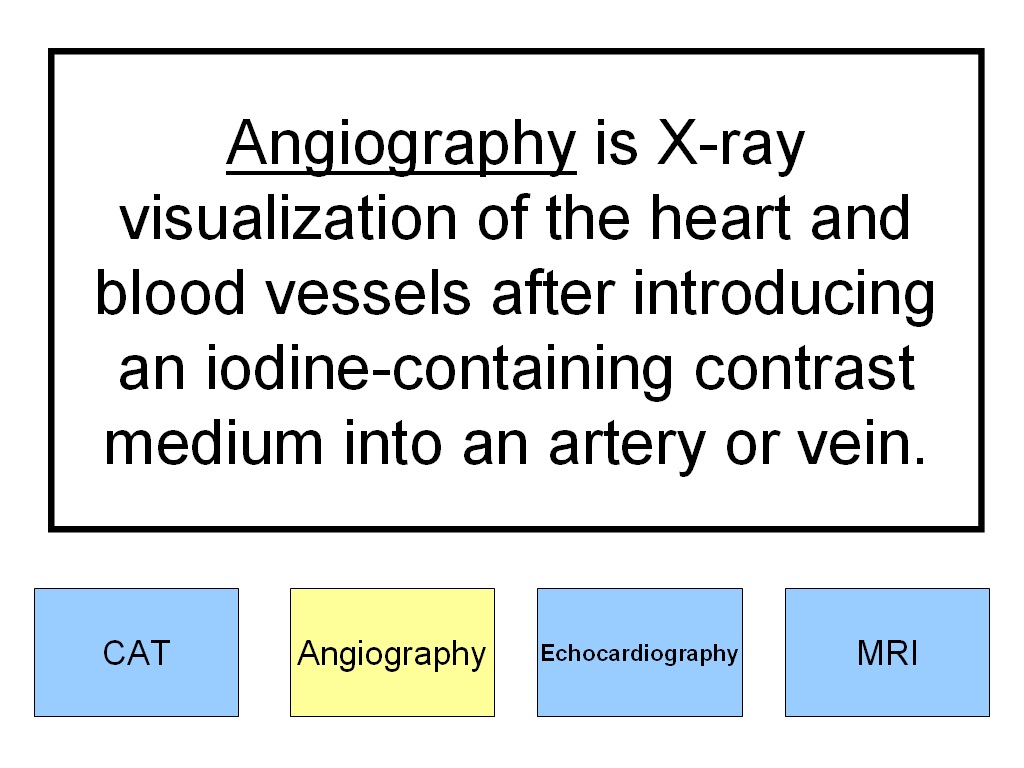 Student Survive 2 Thrive Cardiovascular Diagnostic Procedures Practice