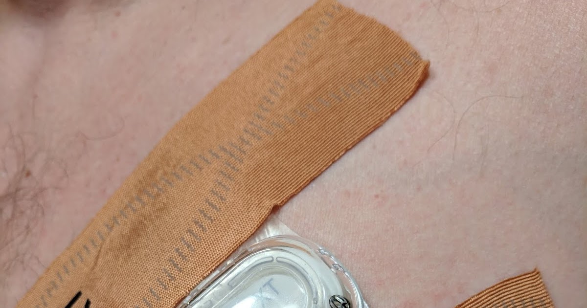 Afib Rider Monitoring My Every Move