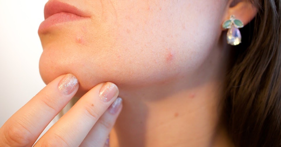does acne have a purpose