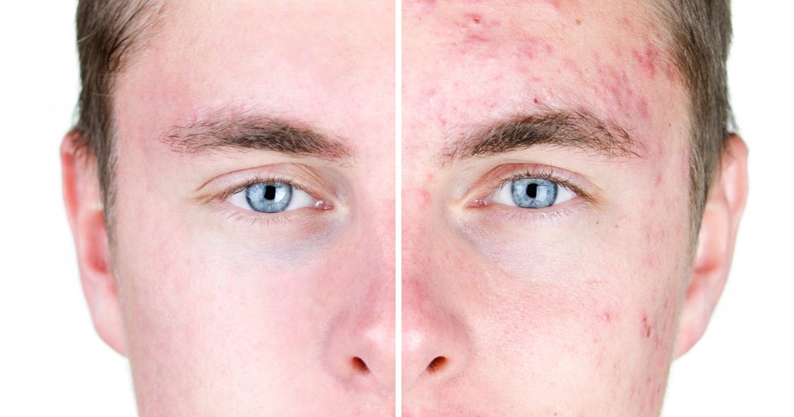 THE BEAUTY BUSINESS by Jana Elston Vitamin A In Skin Care Benefits