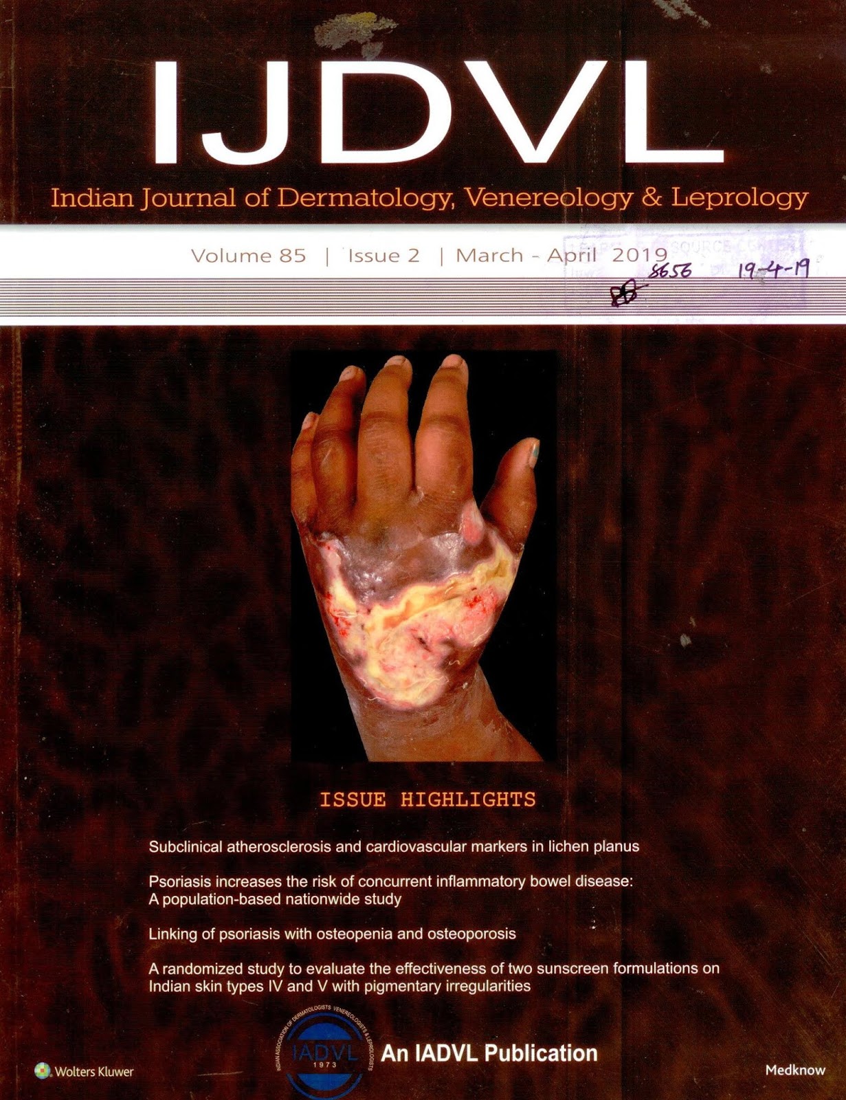 http://www.ijdvl.com/showBackIssue.asp?issn=0378-6323;year=2019;volume=85;issue=2;month=March-April