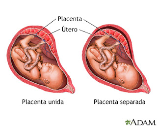 datos sobre el desprendimiento de la placenta