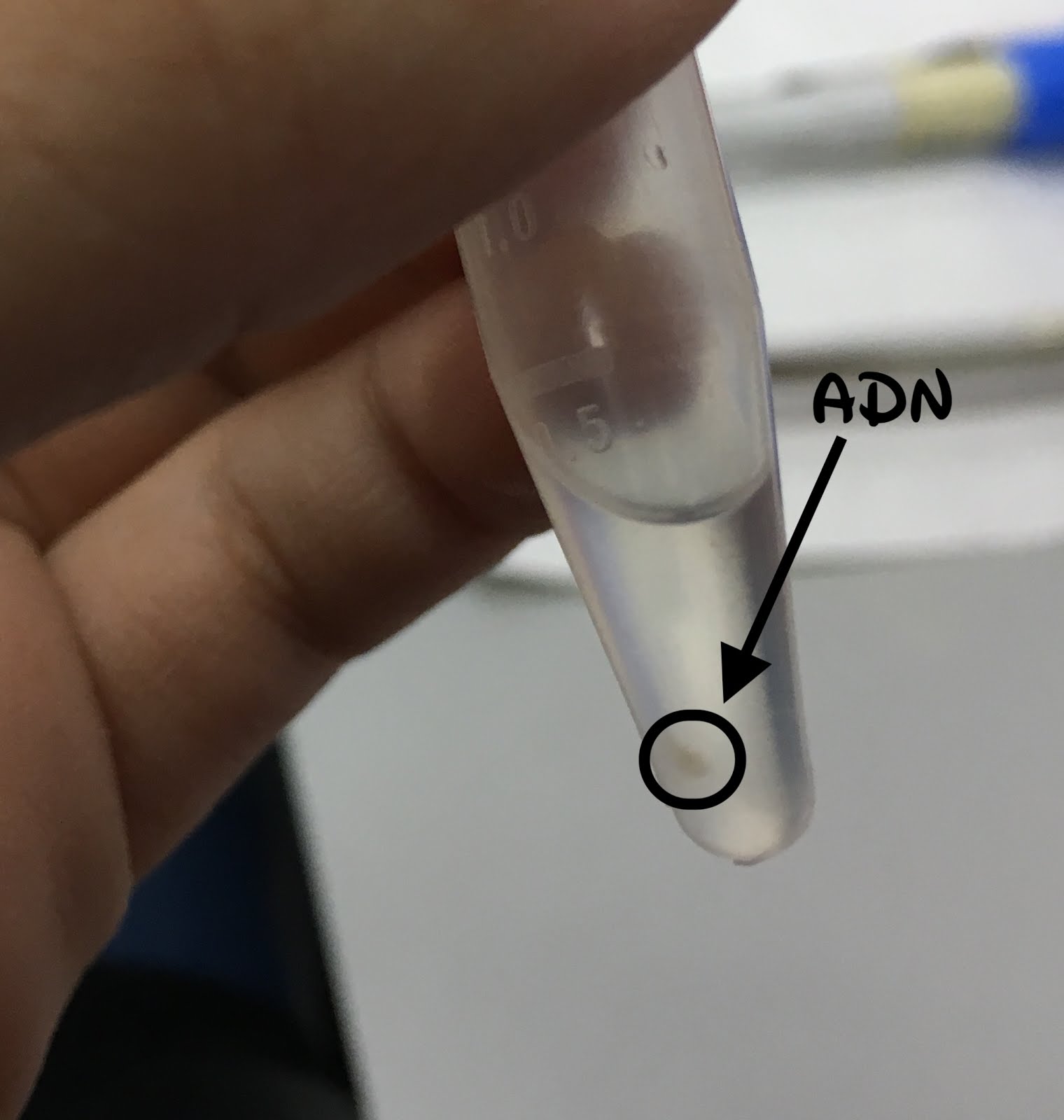 Extracción del ADN Extracción del ADN