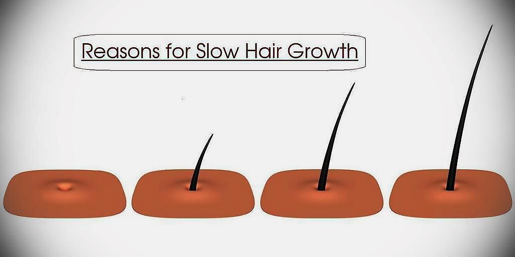 Aggregate more than 82 reasons for slow hair growth best in.eteachers
