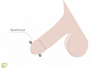 2%2BApadravya - El piercing genital en los hombres -