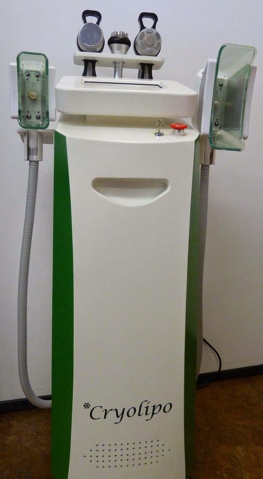 Kryolipolysevorhernachher