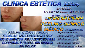 MARBELLA PEELING FACIAL QUIMICO MARBELLA PEELING FACIAL QUIMICO MEDICO PARA ELIMINACIÓN , QUITAR , TRATAMIENTO: ACNÉ , MARCAS , CICATRICES , MANCHAS ,PECAS , ESTRÍAS , MANCHAS