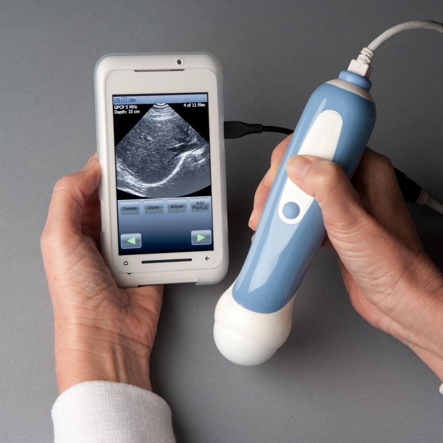 Classification of Gadgets