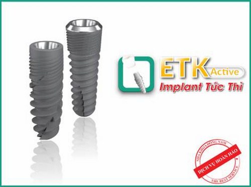 PHỤC HÌNH RĂNG SỨ TRÊN IMPLANT QUÁ SỚM VÀ NHỮNG TÁC HẠI -10