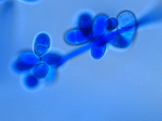 Fun With Microbiology (What's Buggin' You?) Trichothecium roseum