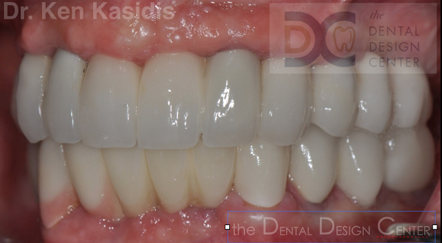 implant%2Bdentist%2Bdental%2Bpattaya%2BAM