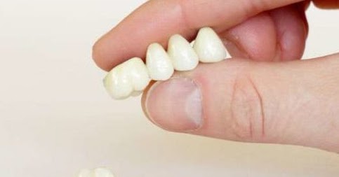 Arti Mimpi Gigi Rontok Semua Menurut Islam