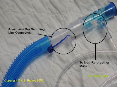 FREMITUS: Inhaled Nitric Oxide Set-up for Nitric Oxide Challenge
