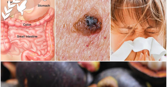 This Fruit Is Banned Because It Fights Colon, Breast, Pancreatic And Skin Cancer