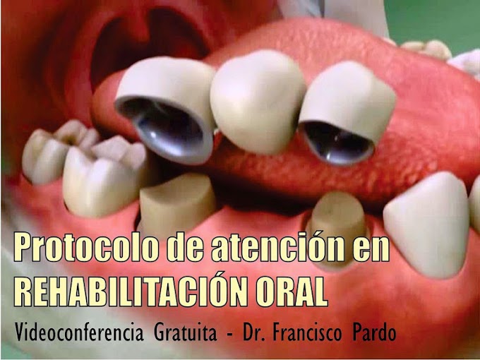 VIDEOCONFERENCIA: Protocolo de atención en la rehabilitación oral - Dr. Francisco Pardo