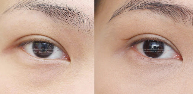 before and after photo of Kate Double Eyelid Remake Liner