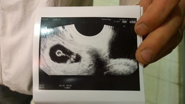 raskaus, blogi, ultraäänikuva, ensimmäinen lapsi, vauva,