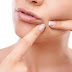 Pimples को दूर करने के घरेलु नुस्खे/How to Remove Pimples and Acne in Hindi