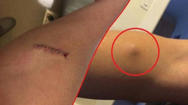 Hati-hati 15 Tanda Kanker ini  Sering Diremehkan dan Diabaikan Wanita