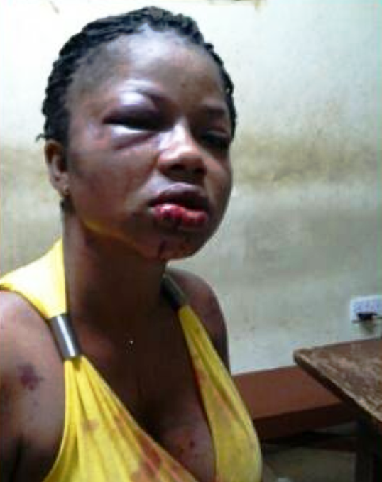 Pregnant lady battered by husband sends him a shocking birthday message