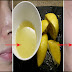 LEMON: Use to Eliminate Darkspots, Dark skin, Wrinkles and Acne and Have a Radiant Skin
