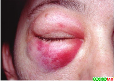 [Emergency] Atlas of Head and Facial trauma | Free Medical Atlas