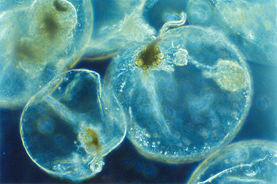 Noctiluca scintillans salah satu jenis pyrrophyta