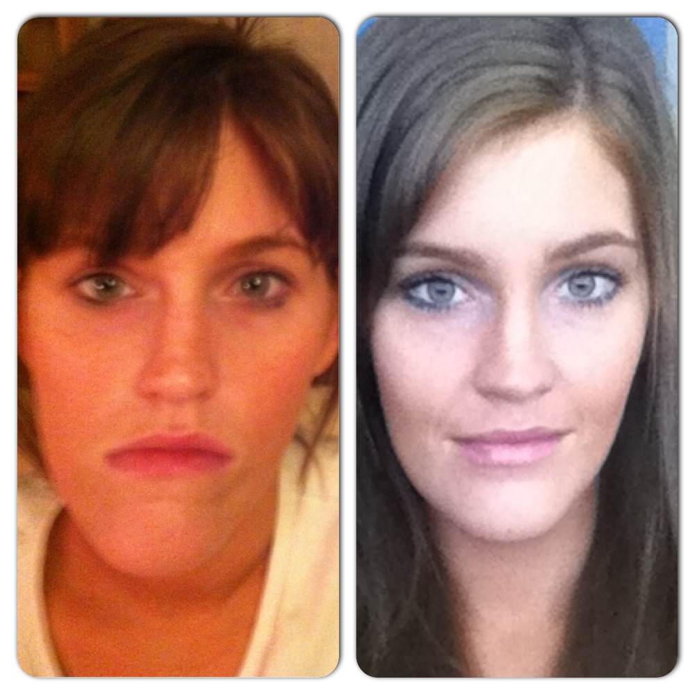 A Guide to Surviving Orthognathic Surgery From the Beginning