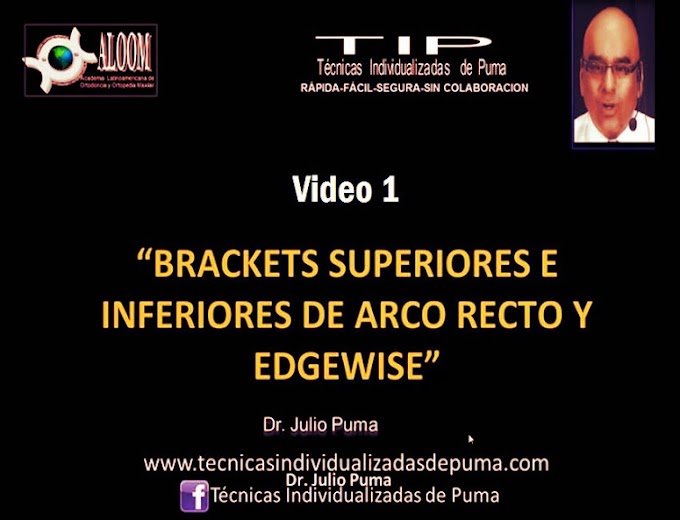 BRACKETS: Arco Recto Roth vs Edgewise - Dr. Julio Puma (Video 1)