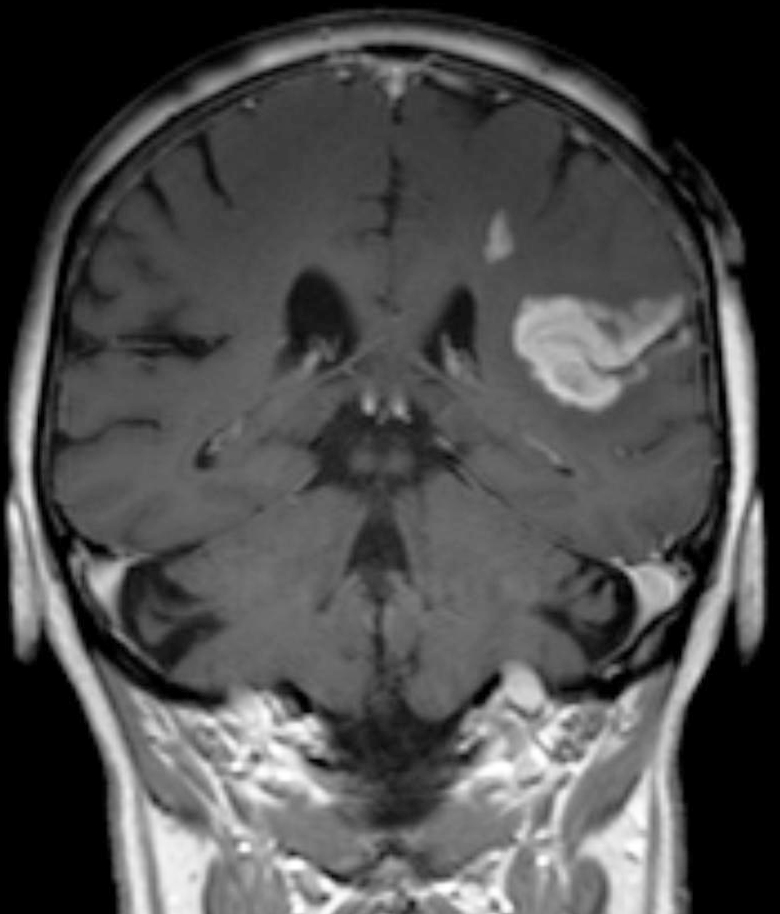 Аппарат мрт 3 тесла. Мрт головы курган. Псевдоопухоль головного мозга. Мрт головного мозга томограф. Компьютерная томография головы.