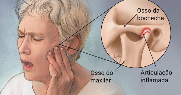 Tensão na face e o diagnostico de DTM muscular - Portal Patologia