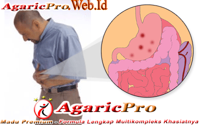 obat herbal penyakit maag obat herbal penyakit maag