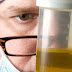 5 Manfaat Dari Urine Di Masa Depan yang Luar Biasa