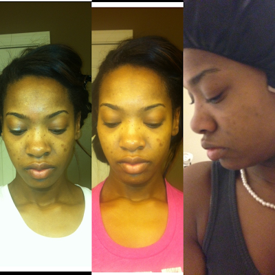 rid horrible spots those getting dark taken third nov second week last