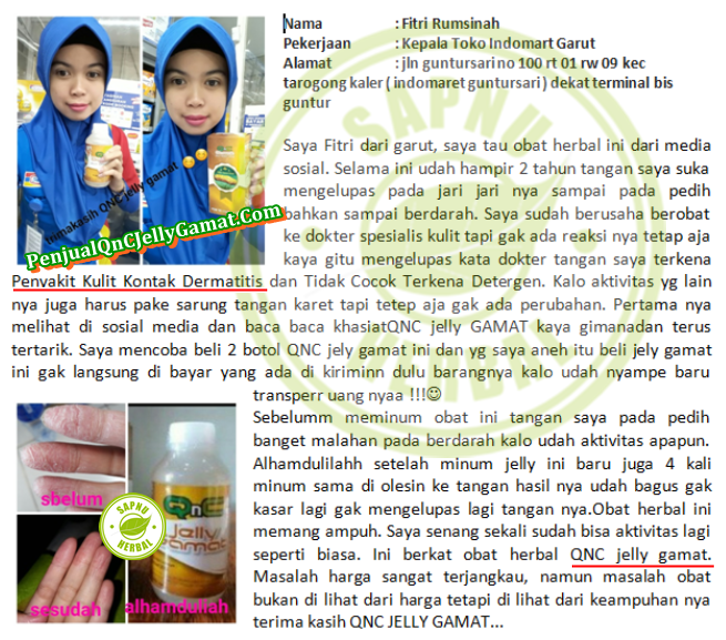 Cara Mengobati Dermatitis Atopik Secara Alami Terbukti Ampuh ~ TESTIMONI QNC JELLY GAMAT Cara Mengobati Dermatitis Atopik Secara Alami Terbukti Ampuh ~ TESTIMONI QNC JELLY GAMAT