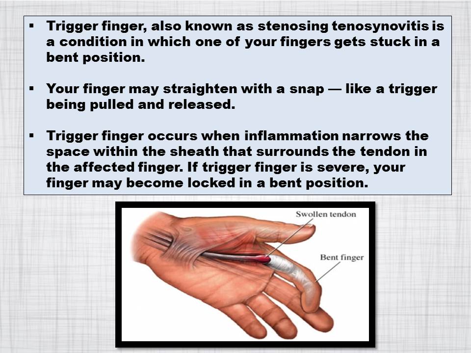 WONG MEDICAL CENTRE IPOH 黄氏医疗中心 TRIGGER FINGER