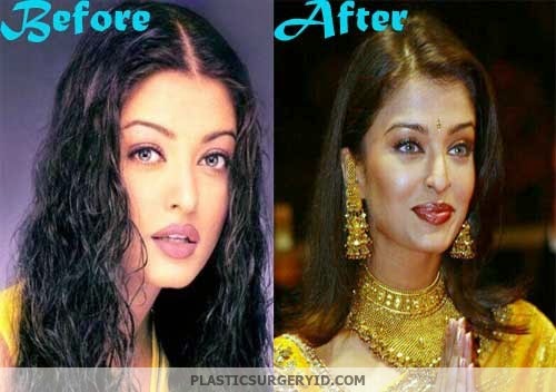 Aishwarya Rai Plastic Surgery Nose Job Before And After Pictures
