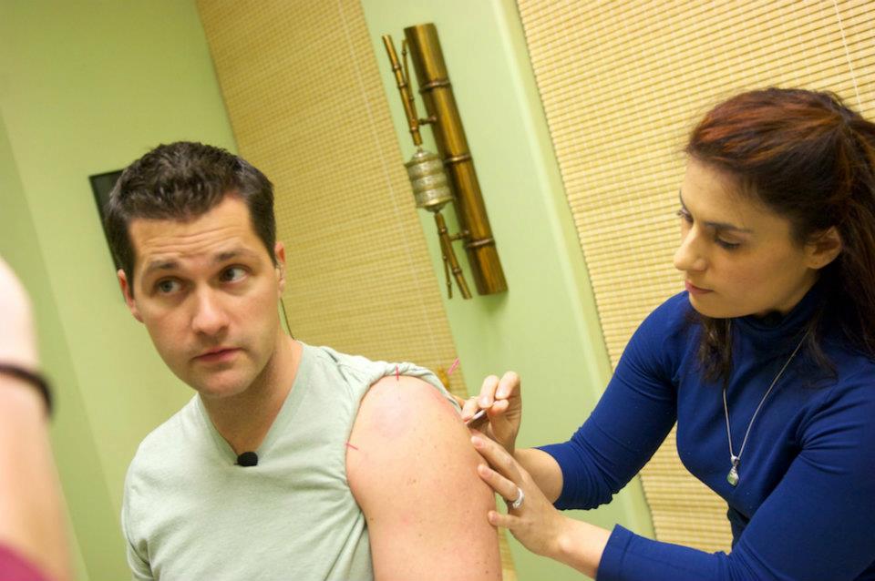 Acupuncture for Improving Health and WellBeing Acupuncture Treatment