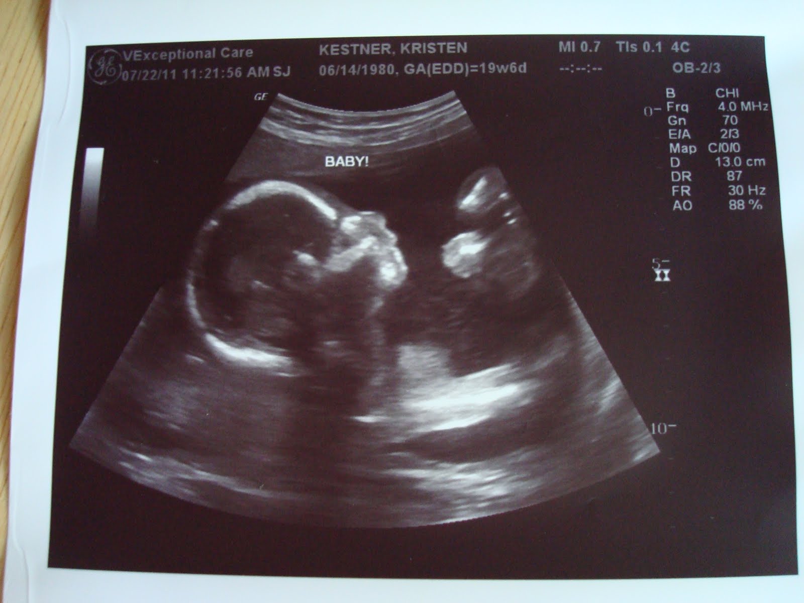 The Hoffman Family Baby Boy Hoffman Ultrasound