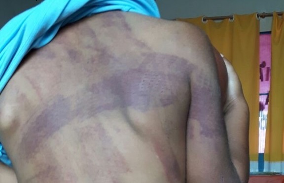 Menino de 4 anos é espancado pela mãe e pelo padrasto em Rondominas e Jaru Menino de 4 anos é espancado pela mãe e pelo padrasto em Rondominas e Jaru